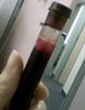 a vial of blood