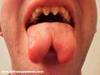 Tongue Splitting
